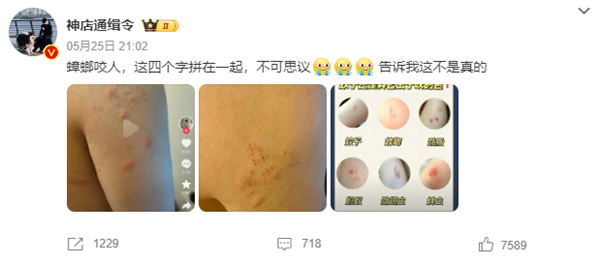 “蟑螂咬人”上热搜 《博物杂志》分析辟谣：三种可能